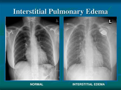 PPT - Back to Basics Radiology 2010 PowerPoint Presentation, free ...