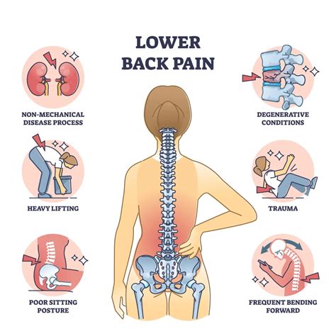 Different Causes Of Lower Back Swelling Or Redness