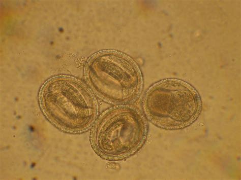 Raccoon roundworm—a hidden human parasite?