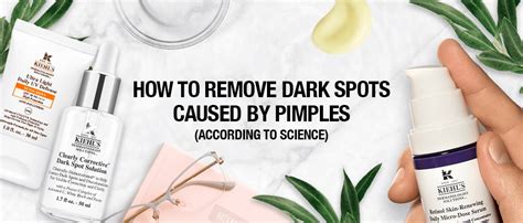 How to Remove Dark Spots from Pimples According to Science | Kiehl's