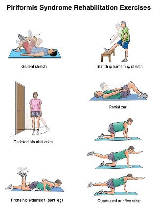 Piriformis-Syndrome-Exercises - Complete Spine and Pain Care