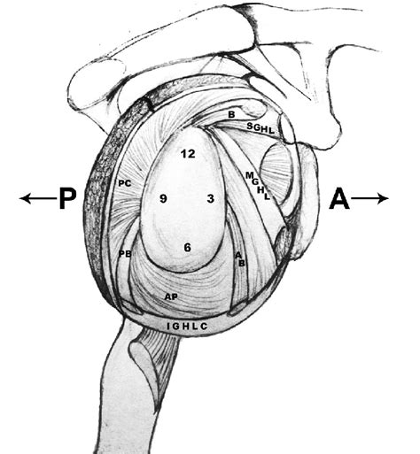 Schematic drawing of the shoulder joint capsule indicating the location ...