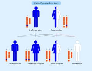 What is Duchenne muscular dystrophy? - Parent Project MD