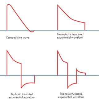 Examples of some monophasic, biphasic, and triphasic waveforms (3–20 ms... | Download Scientific ...