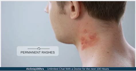 Why do I have permanent rashes on the sides of my neck?