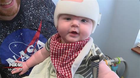 Investigation: Insurance companies denying cranial helmets for infants with flat head syndrome ...