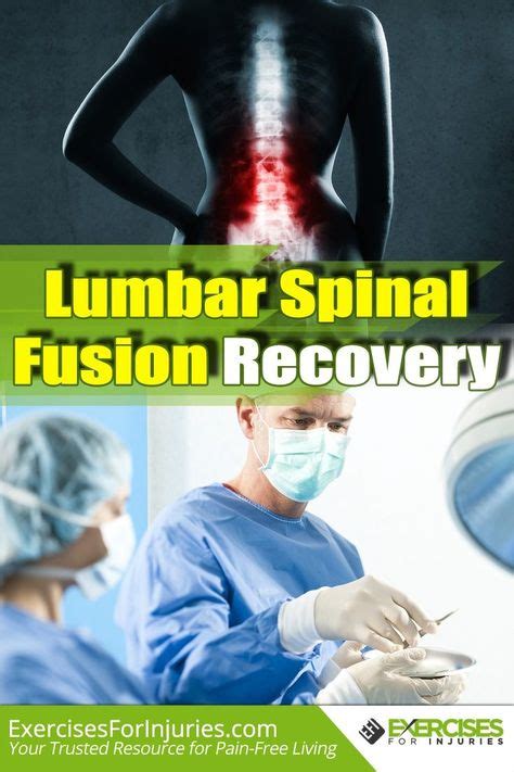 Lumbar Spinal Fusion Recovery | Spinal fusion, Spinal fusion surgery, Spinal stenosis surgery