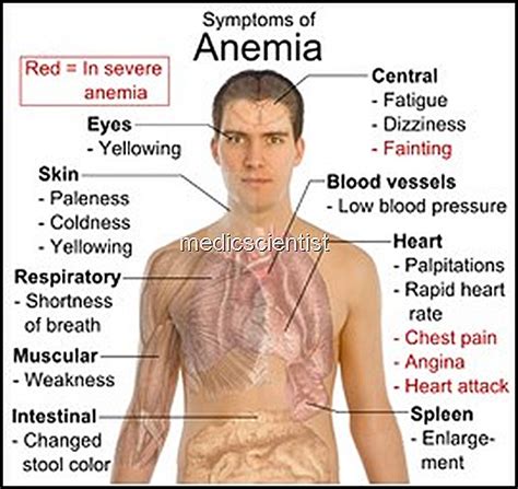 Aplastic Anaemia Causes Symptomes Diagnosis And Treatment - MedicScientist :: Total Health Portal