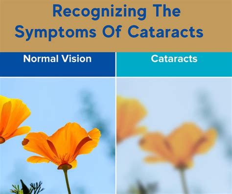 Recognizing the Symptoms of Cataracts | Florida Eye Microsurgical Institute