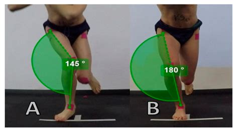 IJERPH | Free Full-Text | Dynamic Knee Valgus in Single-Leg Movement Tasks. Potentially ...