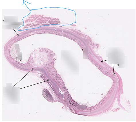 outer ear canal Diagram | Quizlet