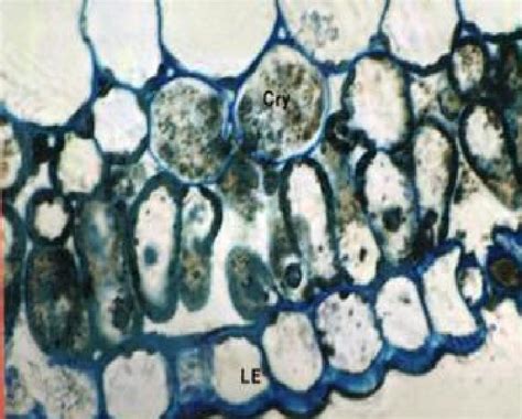 Displayed lower epidermis and a spongy mesophyll tissue whose cells are ...