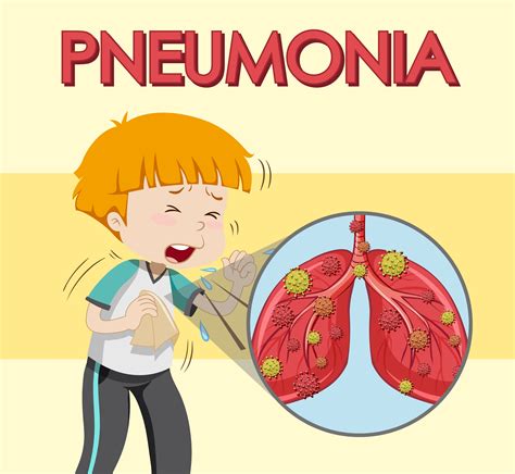 Poster design for pneumonia with boy coughing 1012955 Vector Art at ...