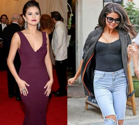 Selena Gomez Plastic Surgery for older looks!