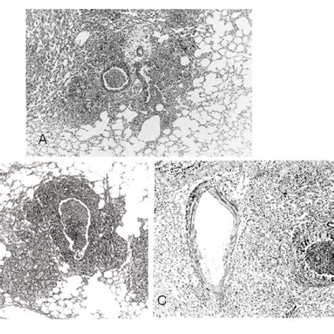 | Mycoplasma pneumoniae pneumonia in human. (A) Chest x-ray shows ...