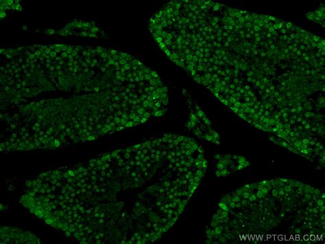 CREST antibody (12439-1-AP) | Proteintech | 武汉三鹰生物技术有限公司