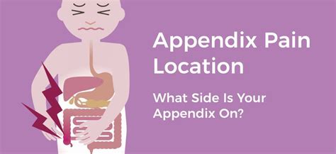 What Side is Your Appendix On? Appendicitis Symptoms, Treatments