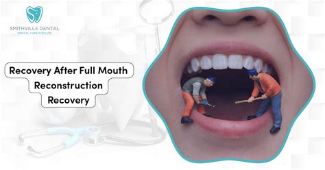 Recovery After Full Mouth Reconstruction Recovery | Smithville Dental