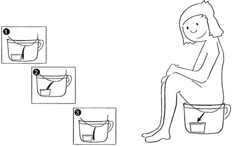 Collection of mid-stream urine specimen when using a potty chair.... | Download Scientific Diagram