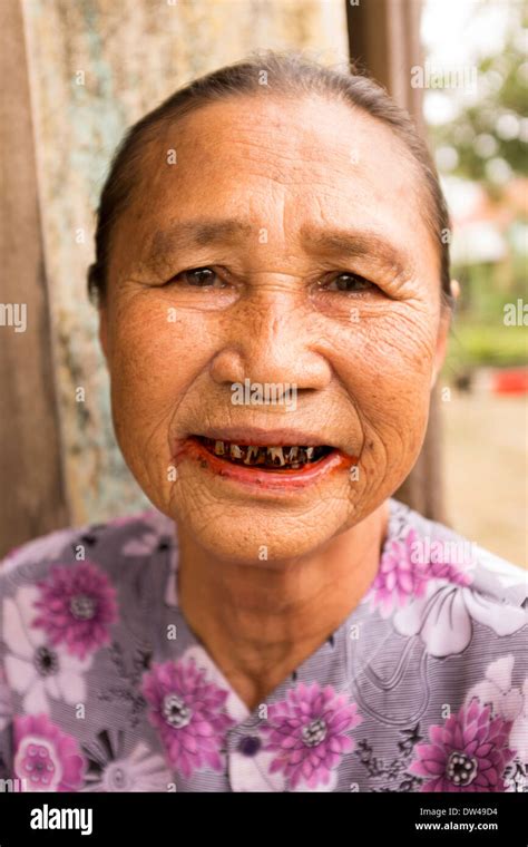 Betel nut teeth hi-res stock photography and images - Alamy