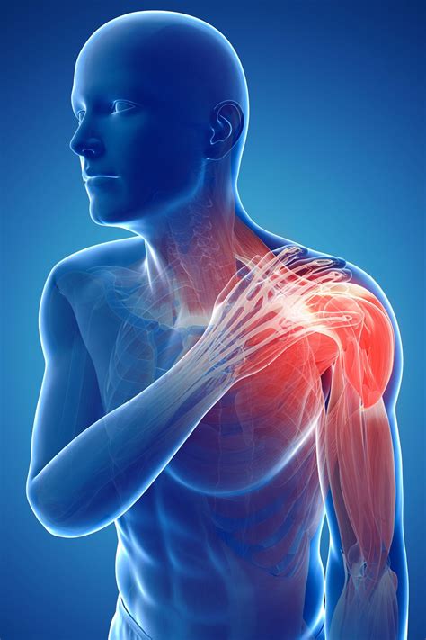 Shoulder Blade Pain: Symptoms, Causes, and Treatment