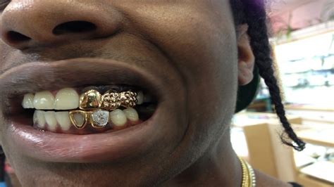 Gold Teeth Asap