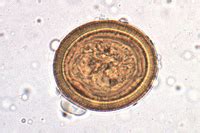 Echinococcus Granulosus Slide