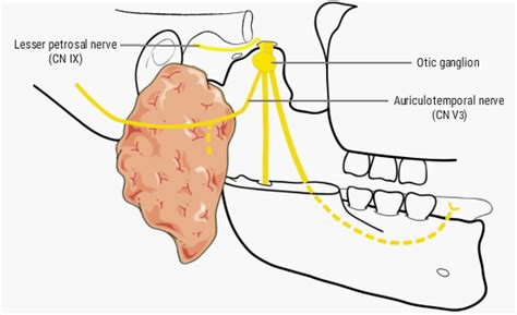 U.Br.Columbia - Drawing Innervation of the parotid gland - English ...