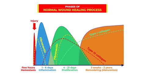 What is Wound Healing Process Definition Phases Types