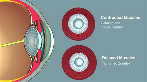 How Do Ciliary Muscles Change The Shape Of The Lens? 16 Most Correct Answers - Chiangmaiplaces.net