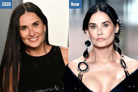 Demi Moore, 58, sparks plastic surgery rumors after looking ...