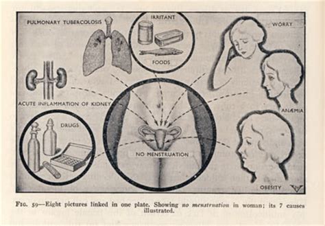 The Wandering Uterus - Society for Menstrual Cycle Research