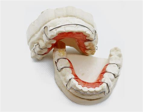 All You Need to Know About Hawley Retainer: Cost, Cleaning & Alternatives - Dental Lab Direct