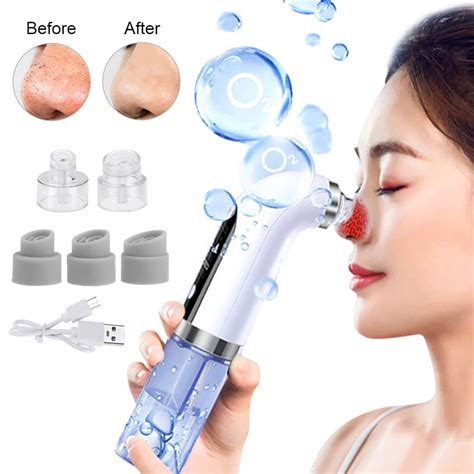 Rechargeable Blackhead Remover Acne Pimple Extractor Vacuum Facial Pore Sucker Cleanser ...