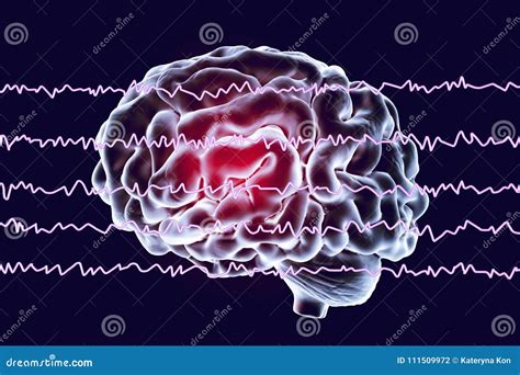 EEG Electroencephalogram, Brain Wave in Awake State with Mental ...