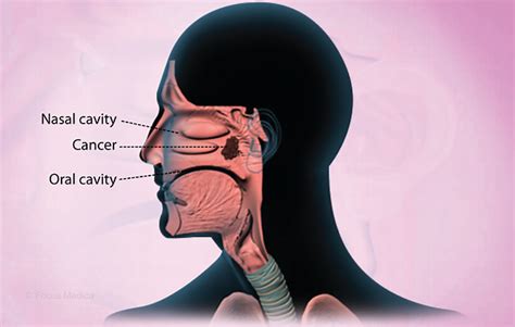 Health Condition : Symptoms, Causes, Treatment and More