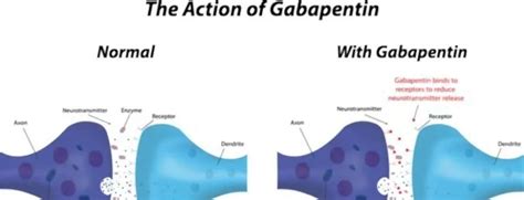 4 Gabapentin Alternatives That Will Help You Find Relief