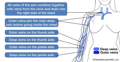 Blood clot in the arm - PatientEducationMD