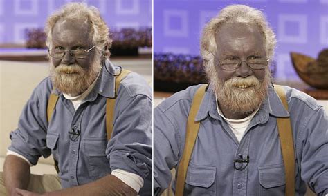 The real life Papa Smurf: Man turned himself BLUE after taking dietary ...