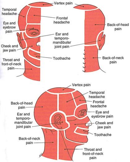 Back of head pain