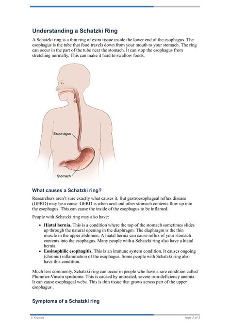 PDF - Understanding a Schatzki Ring - HealthClips Online