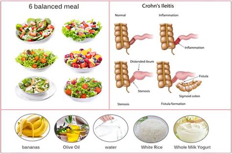 Crohn’s Disease Diet Plan: Foods To Eat & Avoid And Tips | Crohns ...