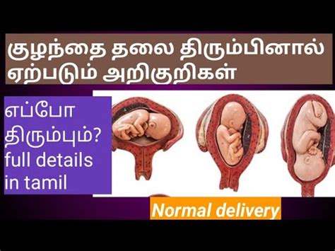 Symptoms of Cephalic position baby in tamil/ Normal delivery - YouTube