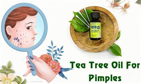 12 Benefits & Uses Of Tea Tree Oil For Pimples On Scalp & Face