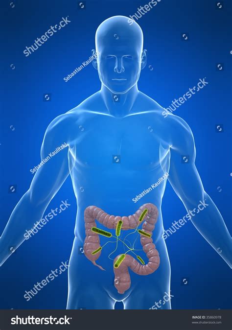 Colon Infection Stock Photo 35860978 : Shutterstock