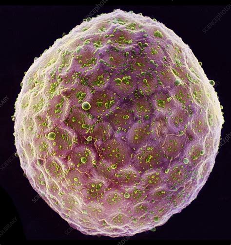 Tobacco plant protoplast, SEM - Stock Image - B060/0066 - Science Photo Library