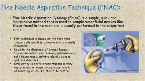 Fine Needle Aspiration Cytology (FNAC)