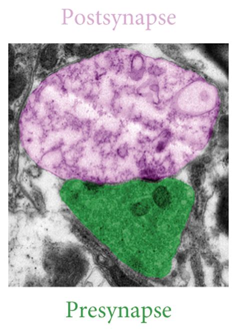 The ultrastructure of synapses in the spinal dorsal horns of all ...