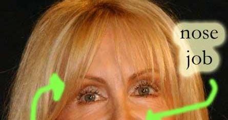 Joan Van Ark Plastic Surgery Before and After Nose Job, Facelift and Cheek Implants | Plastic ...