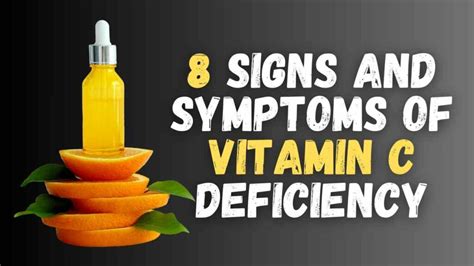 8 signs and symptoms of vitamin C deficiency - Nutrition Meet